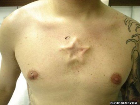 Stupid and weird body modifications (8 pics)