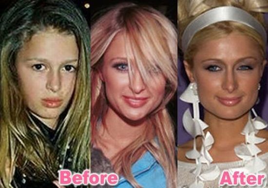 stars_plastic_surgery_32.jpg