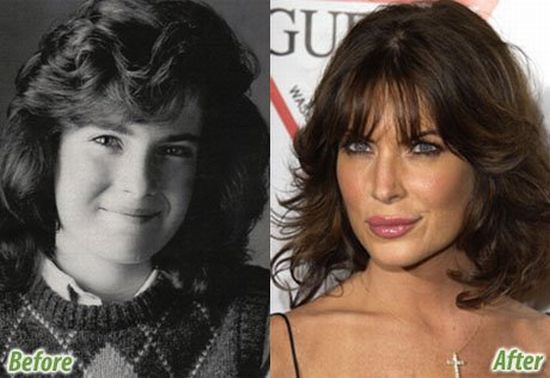 Famous People Who Have Gone Under The Knife