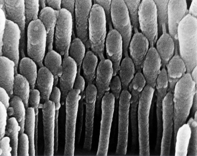 Amazing microscope photography that will make you say wow! (50 pics)