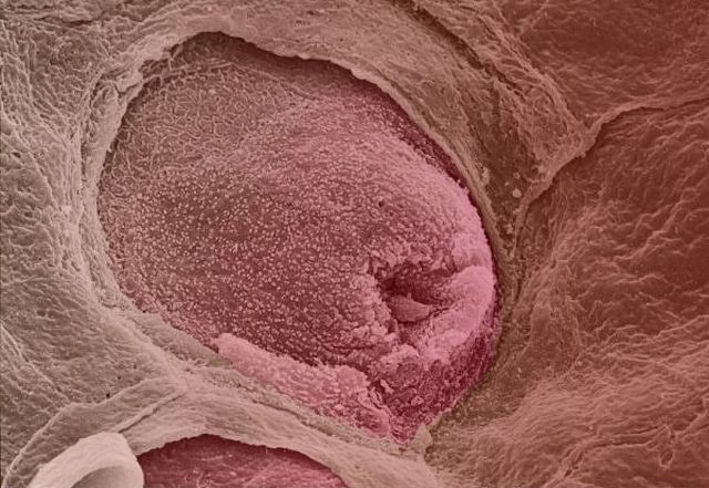 Amazing microscope photography that will make you say wow! (50 pics)