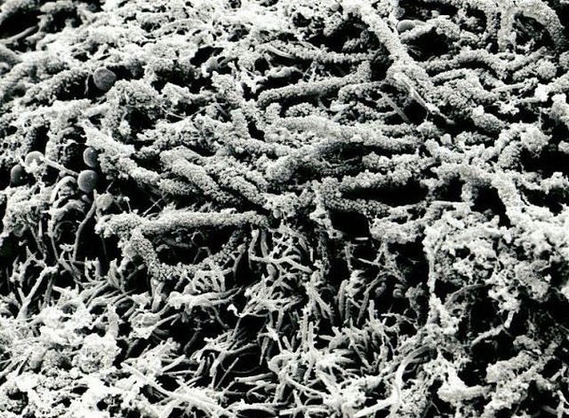 Amazing microscope photography that will make you say wow! (50 pics)
