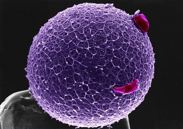 Amazing microscope photography that will make you say wow! (50 pics)