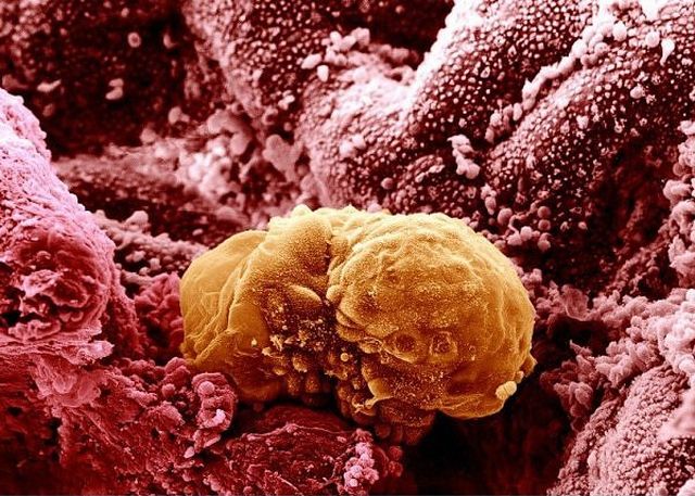 Amazing microscope photography that will make you say wow! (50 pics)