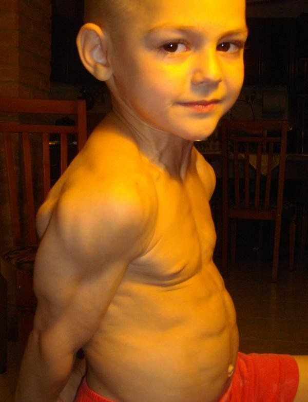 5-Year-Old “Little Hulk” (10 pics+ 1 video)