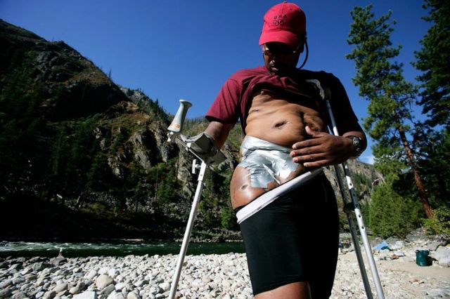 Extreme Therapy – Touching Photos of Disabled People Who Don’t Give Up (19 pics)