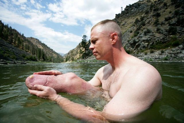 Extreme Therapy – Touching Photos of Disabled People Who Don’t Give Up (19 pics)