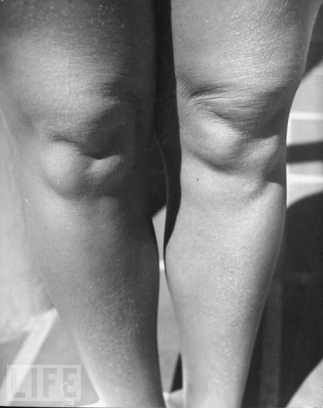 Odd and Rare Phobias (29 pics)