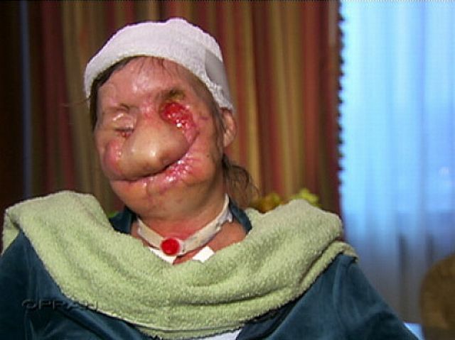 The Best Friends (7 pics + 1 video) HIGHLY GRAPHIC