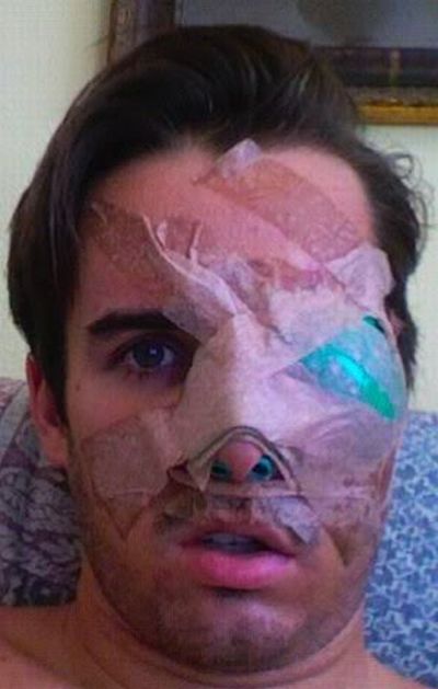 Baseball Hits Face at 100 mph (14 pics)