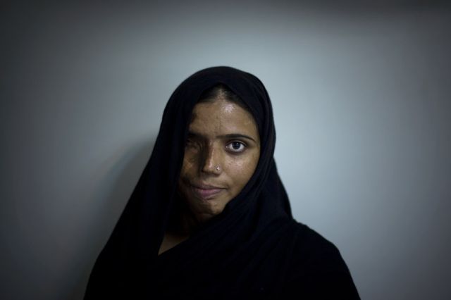 OMG of the Day. â€œAcid Terrorismâ€� Against Women in Pakistan (12 pics + text)