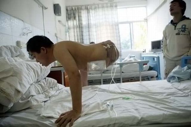Living with Half of a Body (10 pics)
