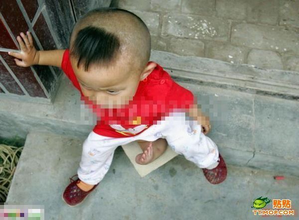 Poor Children with Abnormalities (13 pics)