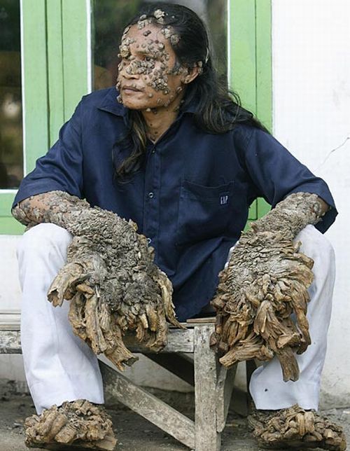 Have You Ever Seen a Tree Man? (19 pics)