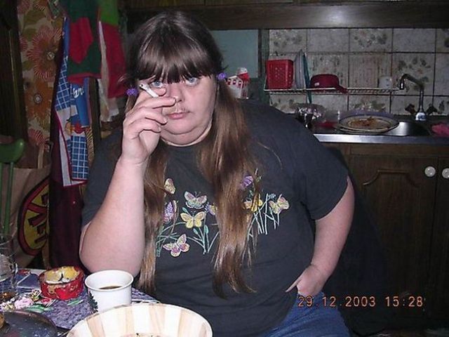 They Don’t Use a Band-Aid for Weight Loss (16 pics)