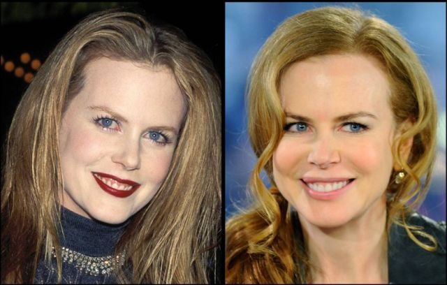 Aging Stars (28 pics) Aging Stars (28 pics)