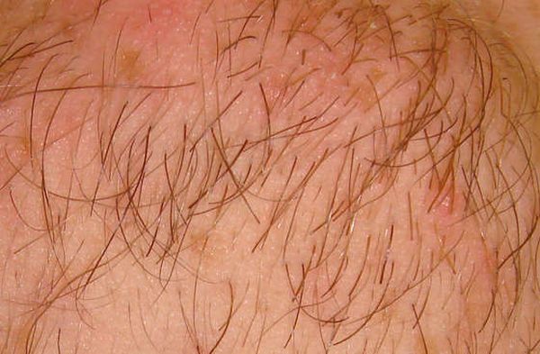 One Way to Shave (23 pics)