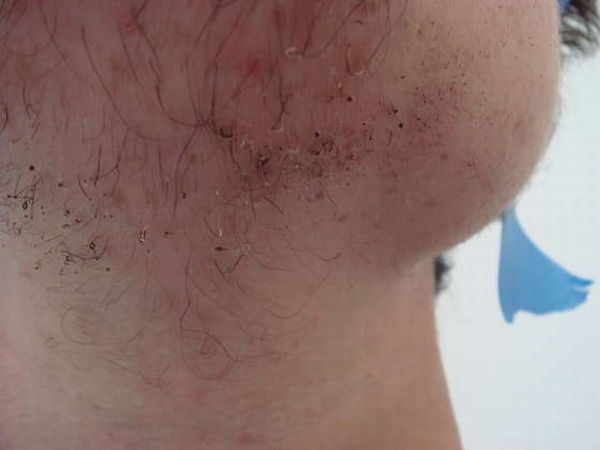 One Way to Shave (23 pics)