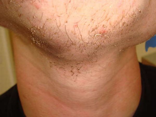 One Way to Shave (23 pics)