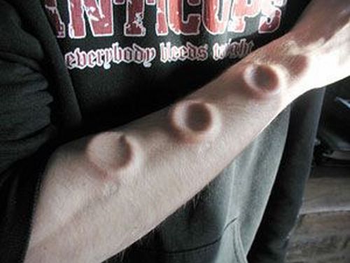 The craziest of WTF Body Modifications (24 pics)