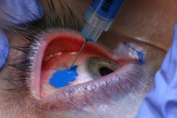 The craziest of WTF Body Modifications (24 pics)