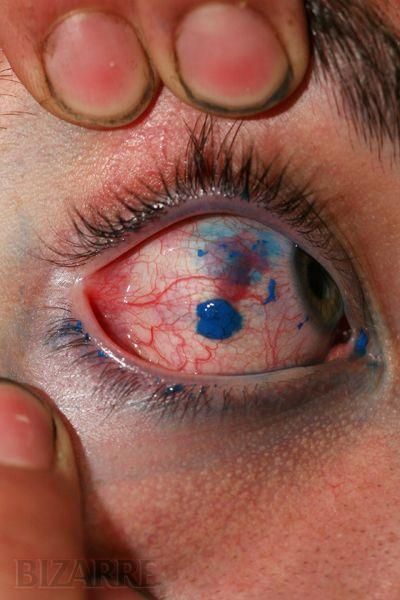 The craziest of WTF Body Modifications (24 pics)
