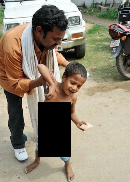 A Boy with Seven Limbs (5 pics)