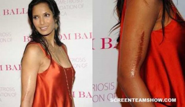 Celebrities and Their Physical Defects (17 pics)