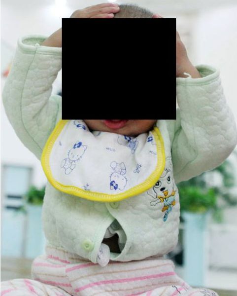 Chinese Boy Born with a Mask-Like Face (5 pics) Chinese Boy Born with a Mask-Like Face (5 pics)