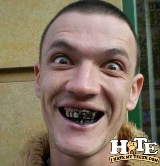 About Teeth (31 pics)