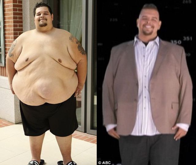An Amazing Loss of Weight