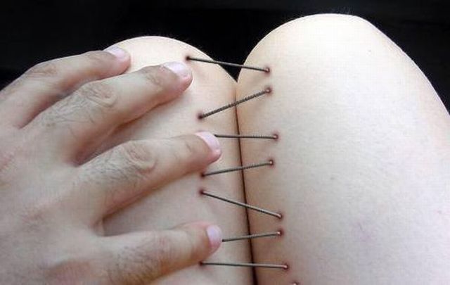 Stitched up (13 photos)