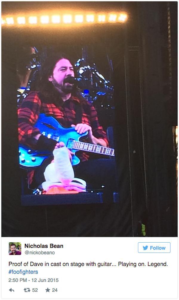 Dave Grohl Jams On Stage Even After Breaking His Leg